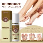 South Moon Herbal Foot Spray Moisturizes And Hydrates Foot Skin And Prevents Dry And Cracked Skin - Image 2