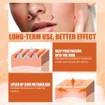 Vitamin C Moisturizing Spray Hydrates And Moisturizes Skin, Lightening Acne Spots And Whitening Spray - Image 5