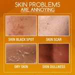 OUHOE Orange Peel Body Lotion, Exfoliation Lightening Dark Spots Brightening And Moisturizing Skin Treatment Lotion - Image 4