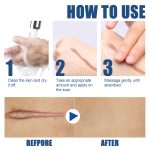 EELHOE Skin Care Cream Gentle Care External Body Care Moisturizing Smooth Skin Care Cream - Image 6