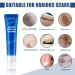 EELHOE Skin Care Cream Gentle Care External Body Care Moisturizing Smooth Skin Care Cream - Image 3