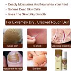 South Moon Herbal Foot Spray Moisturizes And Hydrates Foot Skin And Prevents Dry And Cracked Skin - Image 4