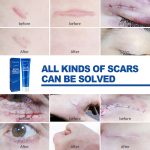 EELHOE Skin Care Cream Gentle Care External Body Care Moisturizing Smooth Skin Care Cream - Image 4