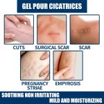 EELHOE Skin Repair Gel Moisturizes Smooth And Moisturizing Skin With Daily Skin Care Gel - Image 3