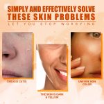 Vitamin C Moisturizing Spray Hydrates And Moisturizes Skin, Lightening Acne Spots And Whitening Spray - Image 4