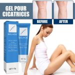 EELHOE Skin Repair Gel Moisturizes Smooth And Moisturizing Skin With Daily Skin Care Gel - Image 2